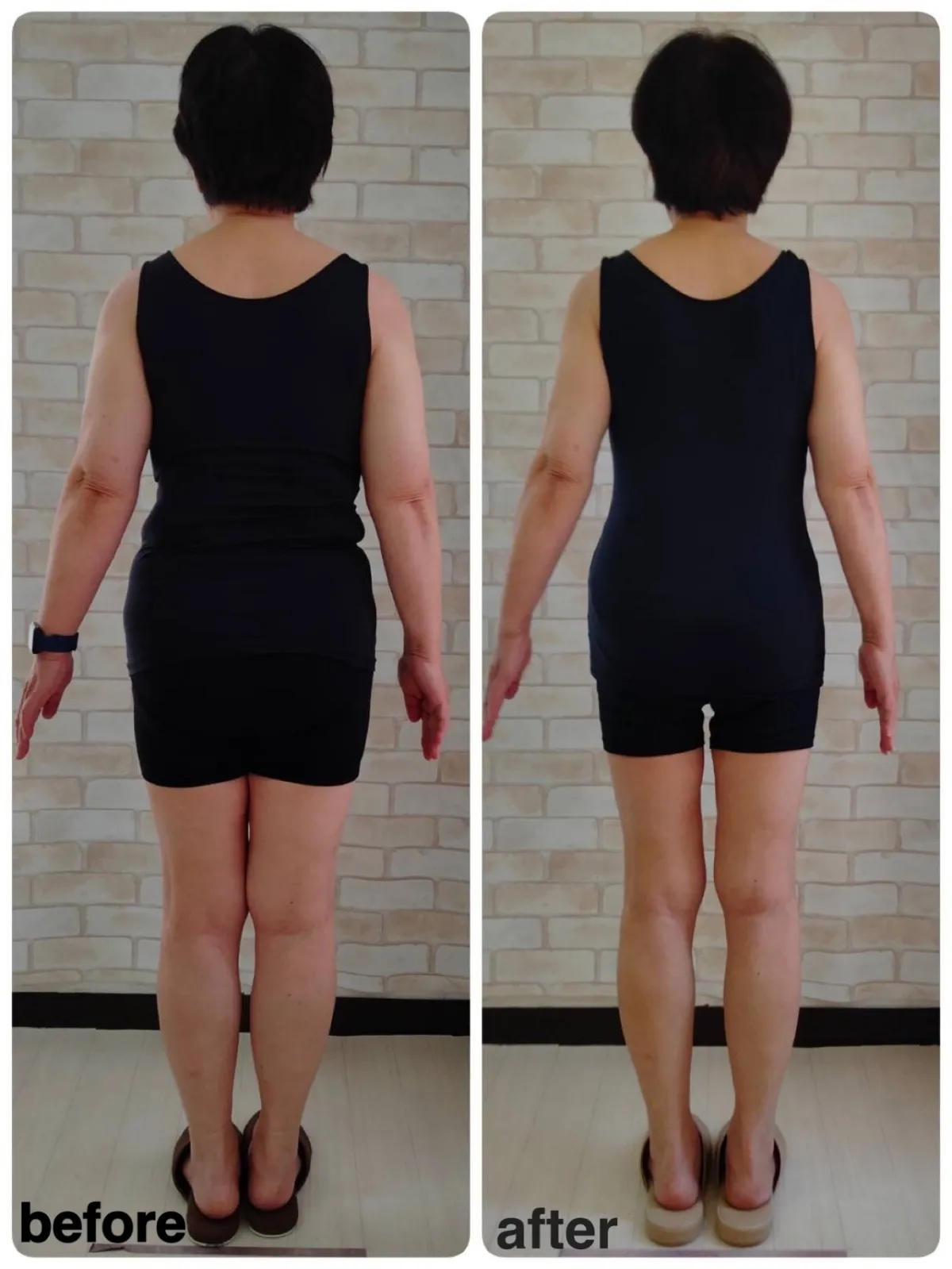 70代女性/3か月/体重-10.3kg/体脂肪率-9%